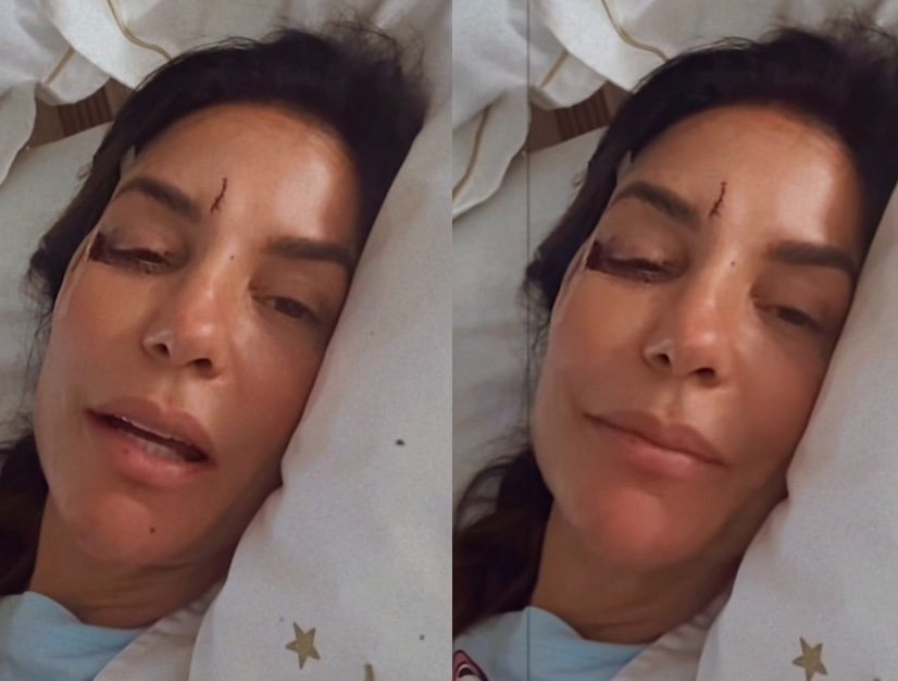 Ivete Sangalo é internada após infecção intestinal e desmaio