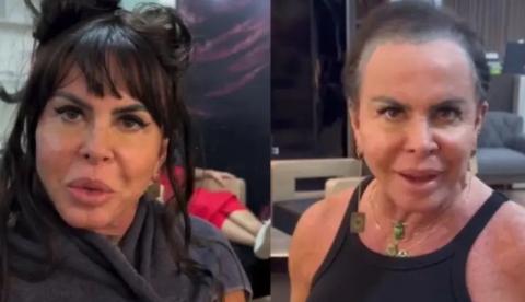 "Não me importo": Gretchen retira prótese capilar e supreende fãs