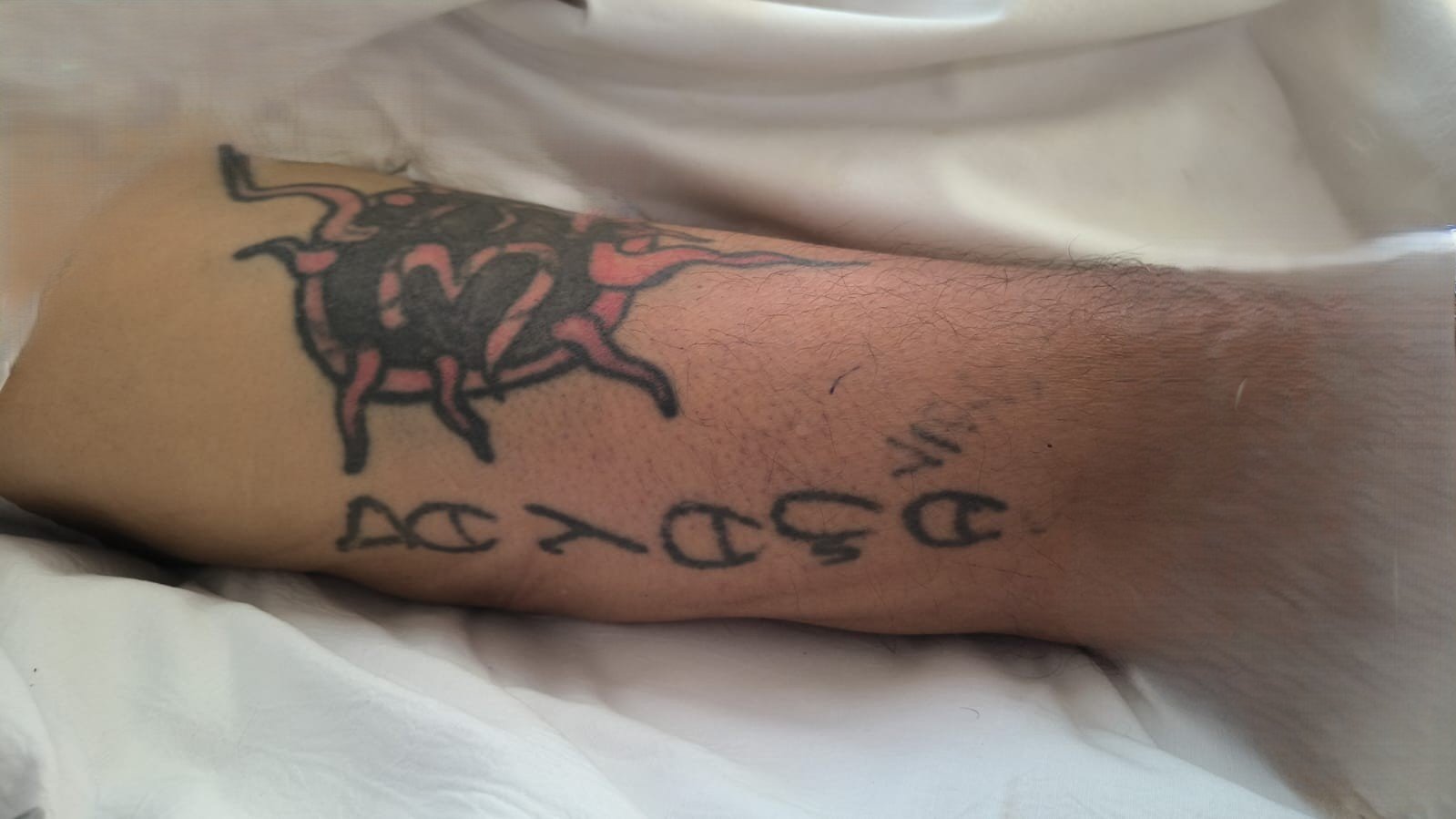 Vítima de agressão: Hospital em Manaus tenta identificar paciente através de tatuagens