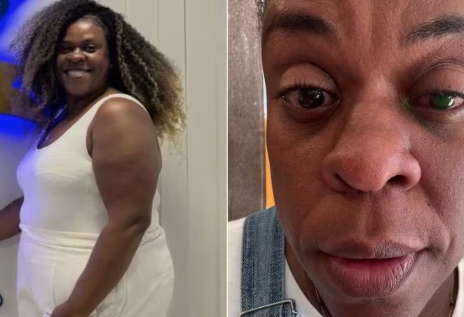 Cacau Protásio volta a enxergar após cegueira temporária e alerta sobre uso de pomada capilar