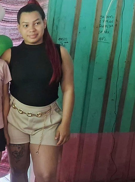 Jovem tem morte cerebral após sofrer acidente com motocicleta em Coari