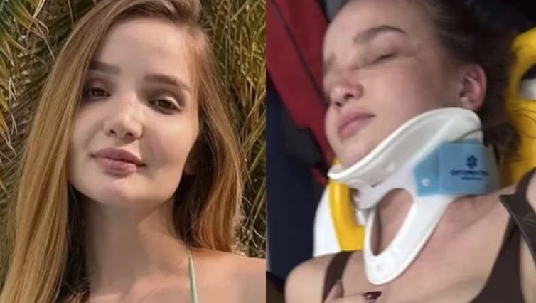 Atriz de 'Chiquititas', Anna Livya Padilha sofre acidente de moto: "Me quebrei"