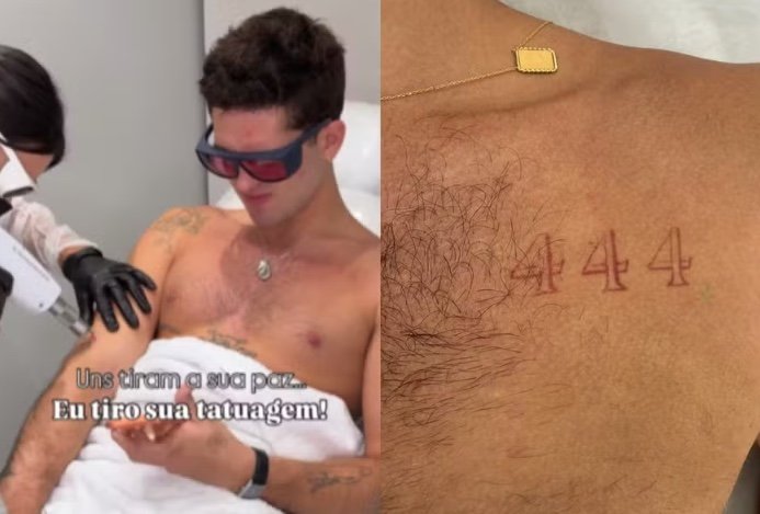 Em fase "clean", João Guilherme decide remover oito tatuagens
