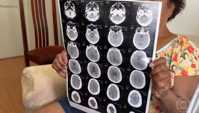 Golpe do exame falso gera prejuízo de até R$ 15 mil a pacientes; veja como se proteger