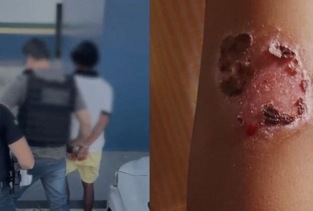 Pai é preso no Cidade de Deus por torturar filhos de 3, 4 e 7 anos para "educá-los"