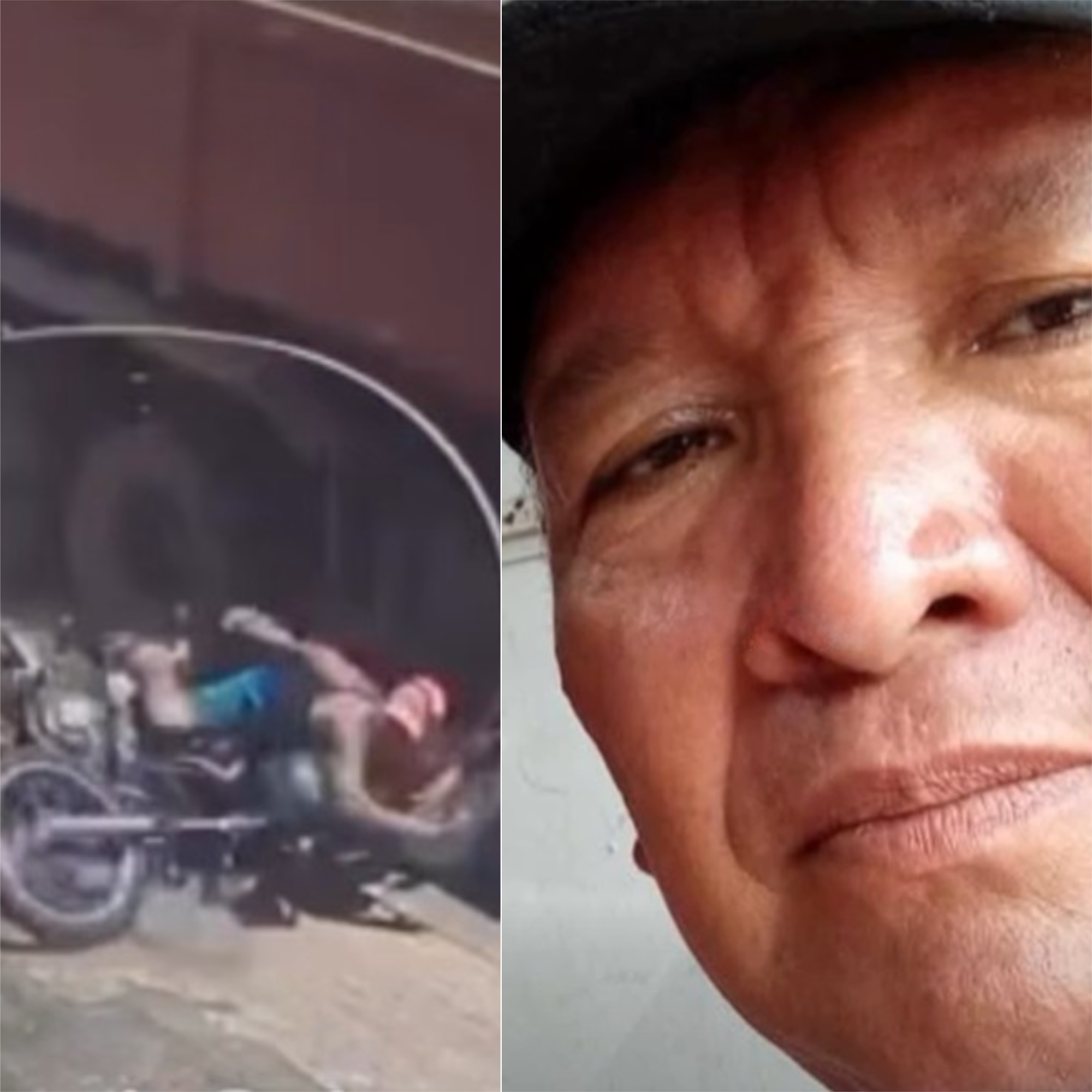 Homem atropelado por caçamba em Itacoatiara morre no hospital em Manaus