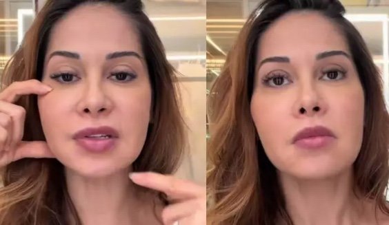 Maíra Cardi revela que fará cirurgia para retirar substância do rosto por risco de necrose