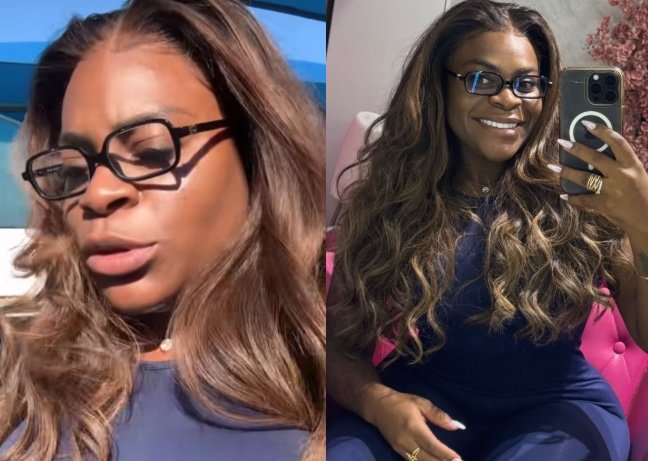 Jojo Todynho anuncia cirurgia no nariz e diz que será "só uma levantadinha"