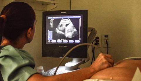 Moradores do Japiim têm até o dia 12 de março para realizar exames gratuitos na Carreta da Saúde