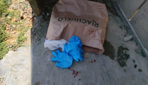 Recém-nascido é encontrado morto dentro de sacola no Alfredo Nascimento