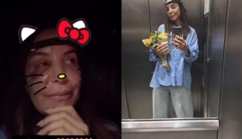 Ivete Sangalo recebe alta e retorna a Salvador após cirurgia no rosto