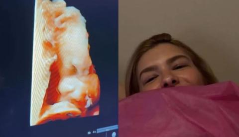 Lore Improta faz ultrassom do segundo filho e Léo Santana reage: "É minha cara"