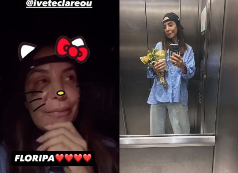 Ivete Sangalo recebe alta e retorna a Salvador após cirurgia no rosto