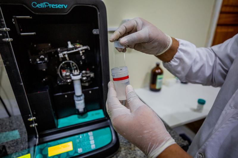 Manaus reduz para 10 dias prazo de entrega de laudos para câncer de mama e colo do útero