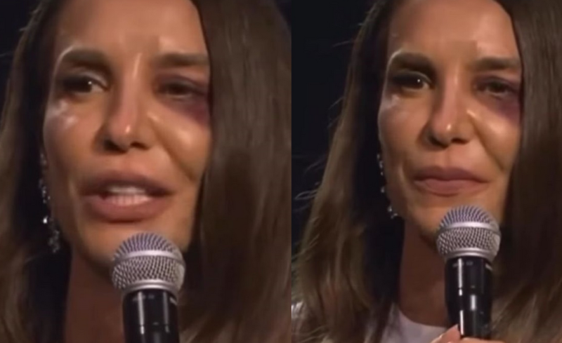 Três dias após susto em Salvador, Ivete Sangalo anuncia cirurgia
