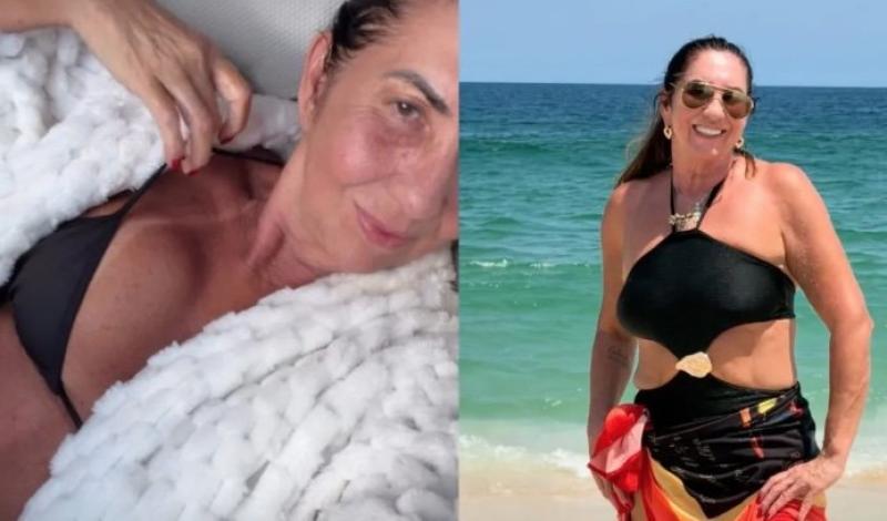 Mãe da Virginia, Margareth Serrão celebra 30 dias de cirurgias com bronzeado renovado