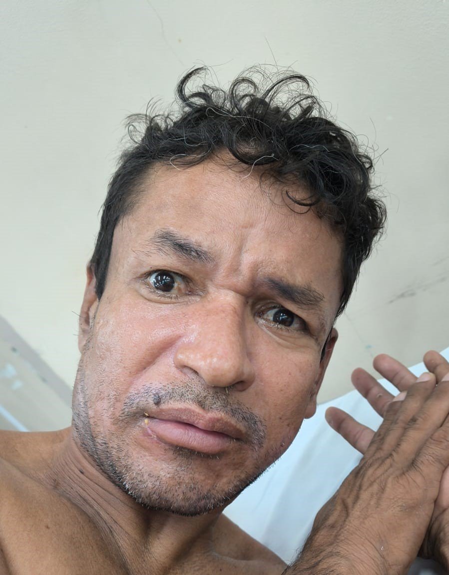 Hospital João Lúcio busca familiares de paciente vítima de atropelamento