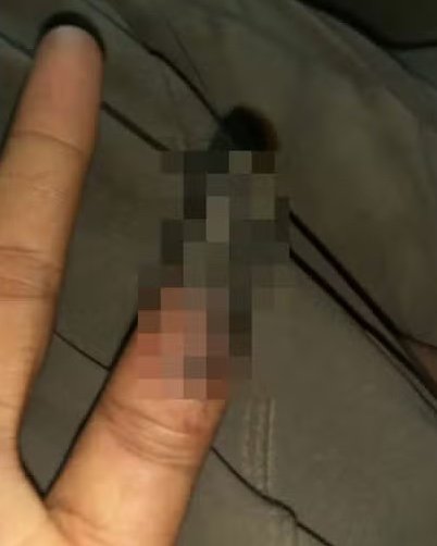 Alpinista perde parte de dedo após retirar luva no Everest