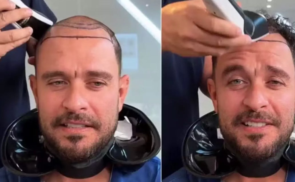 Diogo Nogueira surpreende fãs ao raspar cabelo; vídeo
