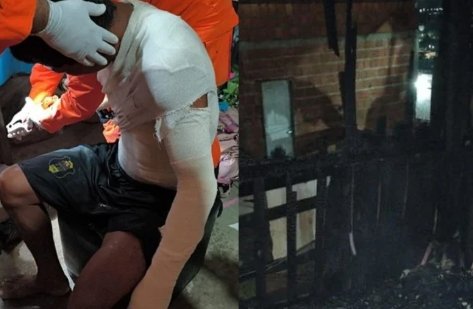 Homem tem 30% do corpo queimado após incêndio que destruiu casa no Nova Cidade