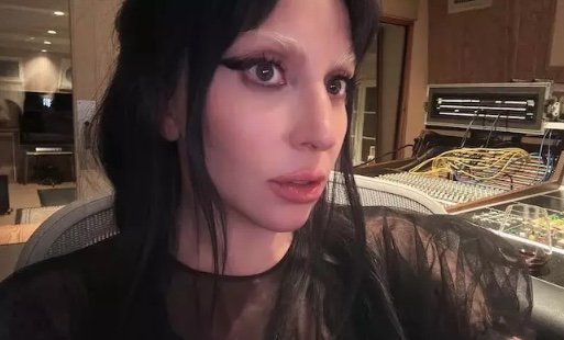 Lady Gaga cancela show e revela piora de problema de saúde