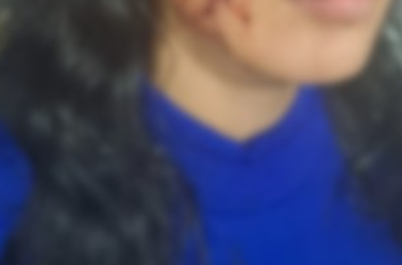 Mulher tem rosto retalhado por ex em Manaus