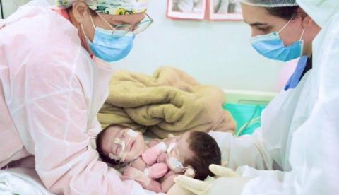 Gêmeas siamesas que nasceram em Manaus comemoram 1 ano após cirurgia complexa