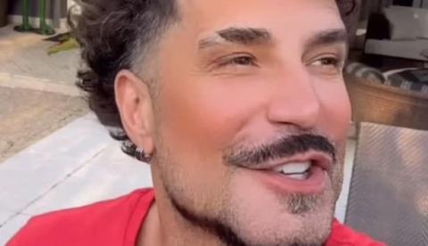 Harmonização de Latino vira alvo de críticas e cantor rebate na web