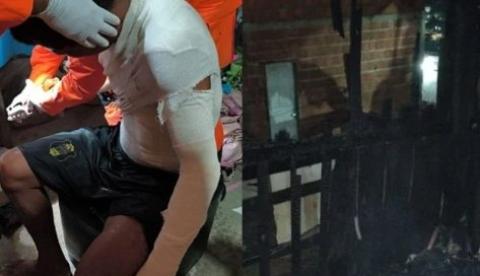 Homem tem 30% do corpo queimado após incêndio que destruiu casa no Nova Cidade
