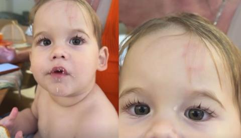 Filho de Virginia, José Leonardo é mordido na escola e influenciadora mostra hematoma