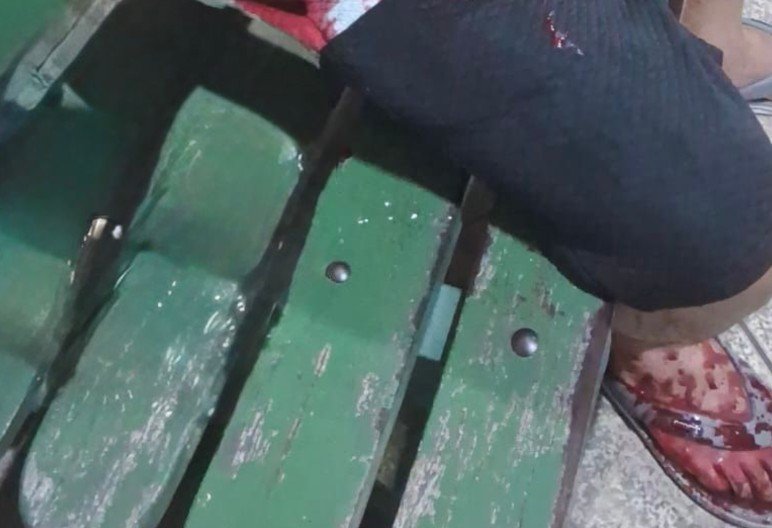 Mulher esfaqueia marido dentro de condomínio após acessar celular da vítima no Lago Azul