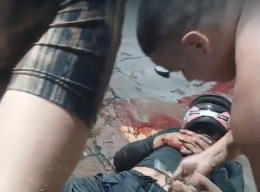 Motociclista tem perna destruída em acidente gravíssimo no Vieiralves