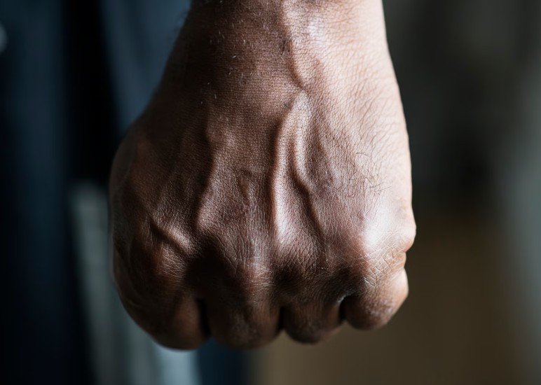 Marido é preso por 'quebrar' a cabeça da mulher ao ser flagrado negociando drogas no Amazonas