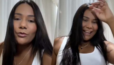 Ex-BBB Chaiany Andrade surpreende com antes e depois de harmonização facial; veja