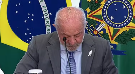Lula inicia radioterapia no couro cabeludo após retirada de câncer de pele