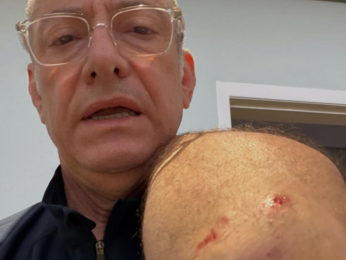 Âncora da Globo é atacado por pitbull e critica descumprimento da lei; vídeo