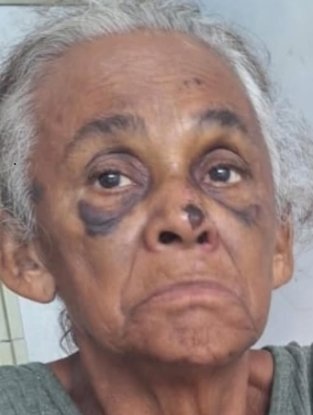 Fundação Dr. Thomas busca familiares de idosa acolhida após ser encontrada em situação de rua