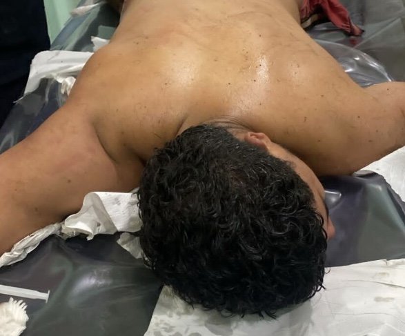Jovem é baleado após tentar tomar arma de PM durante abordagem em Iranduba