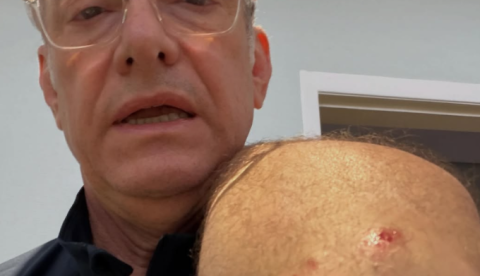 Âncora da Globo é atacado por pitbull e critica descumprimento da lei; vídeo