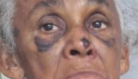 Fundação Dr. Thomas busca familiares de idosa acolhida após ser encontrada em situação de rua