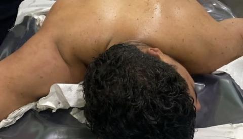 Jovem é baleado após tentar tomar arma de PM durante abordagem em Iranduba
