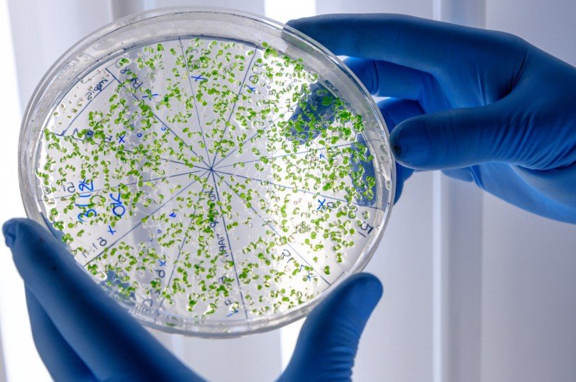 Entenda o risco da 'Pseudomonas aeruginosa', bactéria encontrada em água e produtos da Ypê