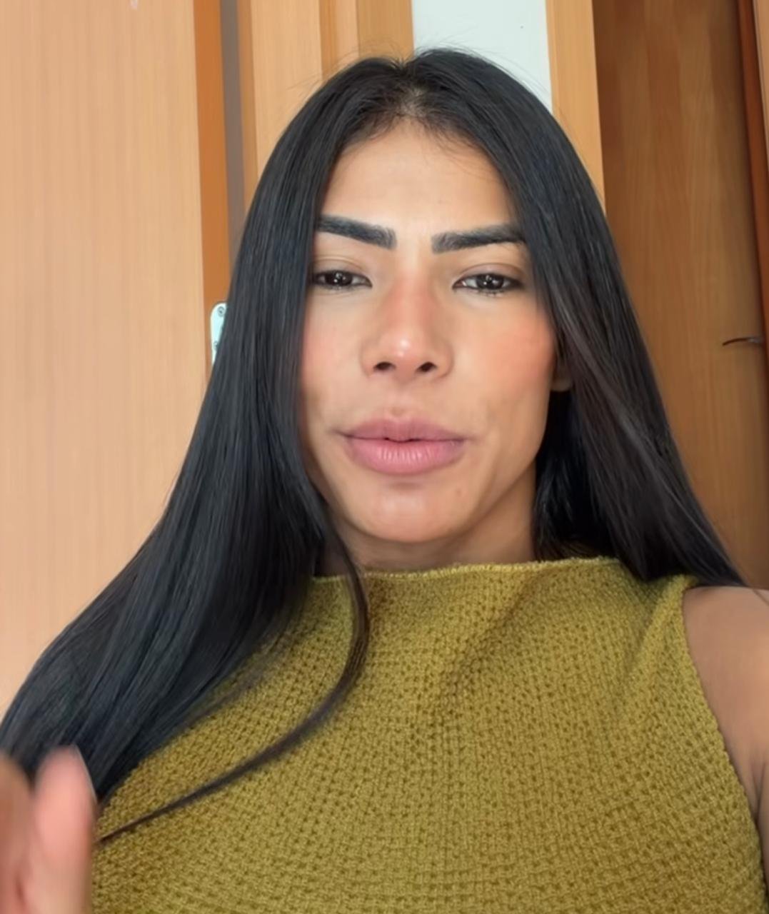 Marciele Albuquerque revela diagnóstico de alopecia