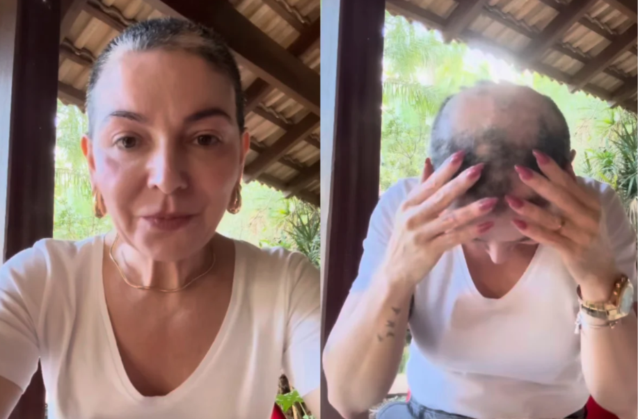 Mãe de Lucas Lucco mostra perda de cabelo e faz desabafo