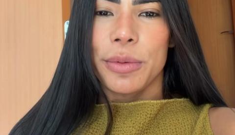 Marciele Albuquerque revela diagnóstico de alopecia