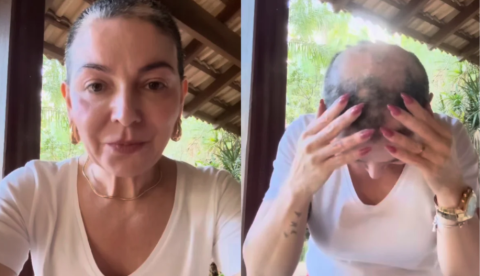 Mãe de Lucas Lucco mostra perda de cabelo e faz desabafo