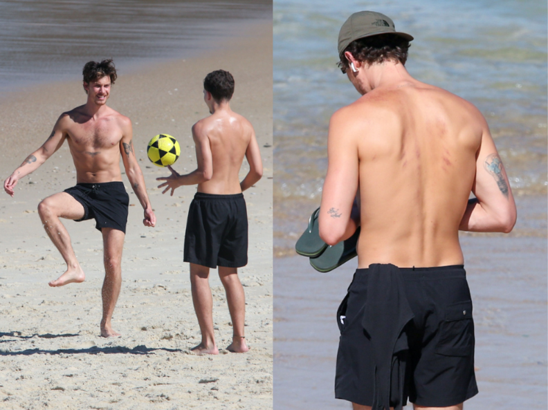Shawn Mendes surge com arranhão nas costas e dá o que falar