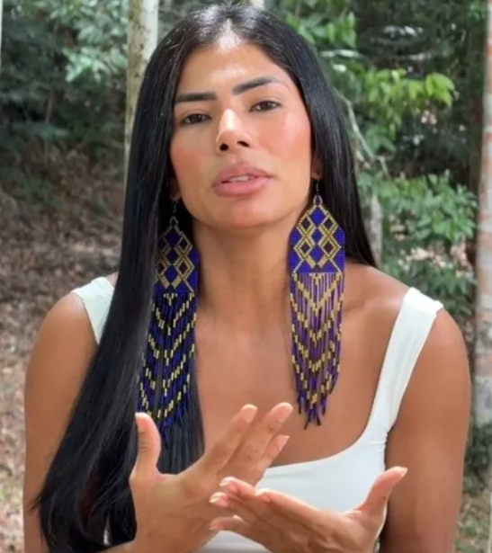 Marciele Albuquerque fala sobre diagnóstico de alopecia