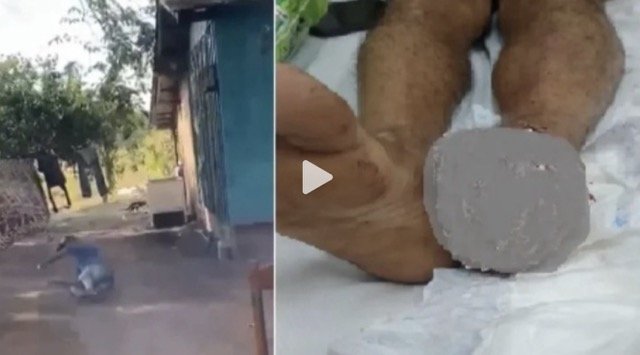"Vou pisar": o segundo antes da explosão que custou o pé de um homem em Rondônia