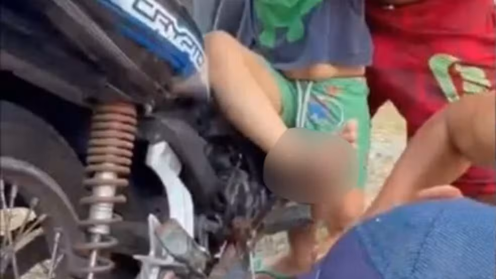 Criança sofre acidente com motocicleta e fica com pedal preso ao pé no Amazonas